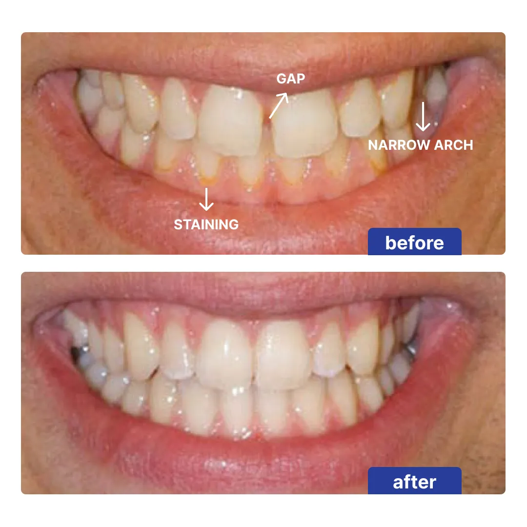 Patient result 3